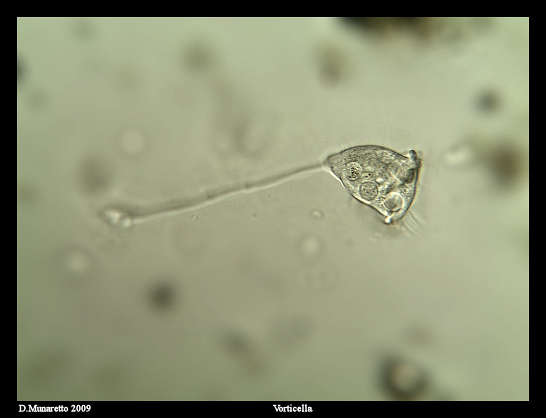 Vorticella...